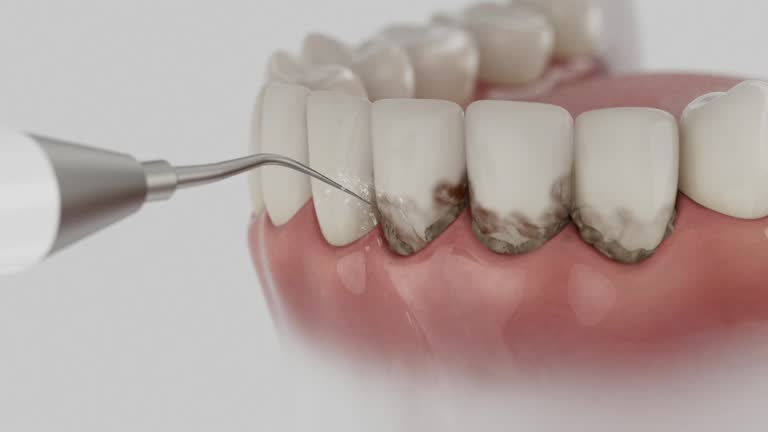 Trusted Teeth Cleaning And Checkup service in West Columbia, SC - Dentist Open Now